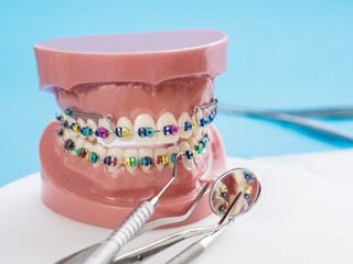 ortopedija-vilica-ispravljanje-zuba