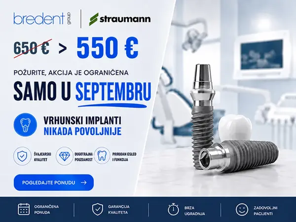 Švajcarski zubni implanti po promotivnoj ceni od 550 evra u septembru