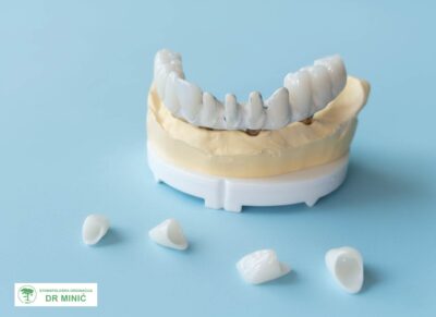 001all-on-four-all-on-six (5)