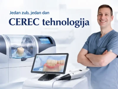 cerec